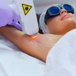 Laser Hair Removal