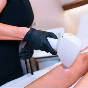 Laser Hair Removal